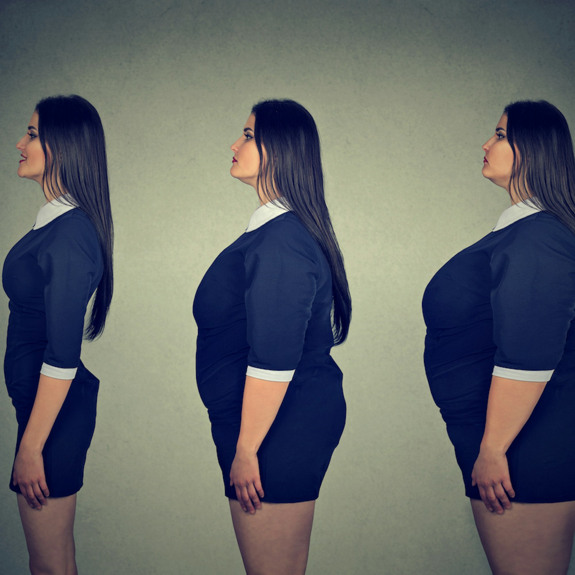 Cuerpo delgado después de cirugía bariatrica